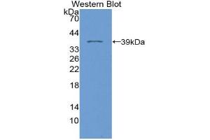 Western blot analysis of the recombinant protein. (Phospholamban Antikörper  (AA 1-52))