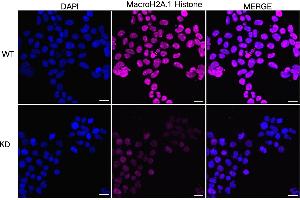 Immunocytochemical staining of HeLa cells using MacroH2A.