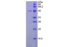 SDS-PAGE analysis of Human GPX4 Protein. (GPX4 Protein)