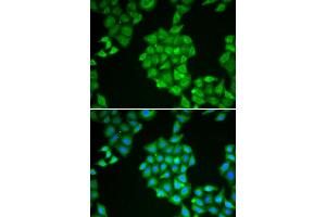 Immunofluorescence analysis of HeLa cell using EPPIN antibody. (Eppin Antikörper)