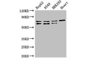 Western Blot Positive WB detected in: HepG2 whole cell lysate, A549 whole cell lysate, HEK293 whole cell lysate, Mouse heart tissue All lanes: HIF3A antibody at 2. (HIF3A Antikörper  (AA 516-669))