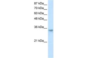 Western Blotting (WB) image for anti-Ribonuclease H2, Subunit A (RNASEH2A) antibody (ABIN2462213) (RNASEH2A Antikörper)