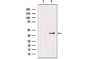 Western blot analysis of extracts from Mouse lung, using EDG3 Antibody. (S1PR3 Antikörper  (N-Term))