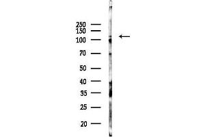 anti-Mitogen-Activated Protein Kinase 8 Interacting Protein 1 (MAPK8IP1) antibody