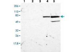 Western blot analysis of Lane 1: RT-4, Lane 2: U-251 MG, Lane 3: A-431, Lane 4: Liver, Lane 5: Tonsil with ZNF234 polyclonal antibody  at 1:250-1:500 dilution. (ZNF234 Antikörper)