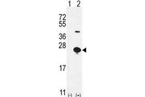Western Blotting (WB) image for anti-Epithelial Mitogen (EPGN) antibody (ABIN2996100) (Epigen Antikörper)