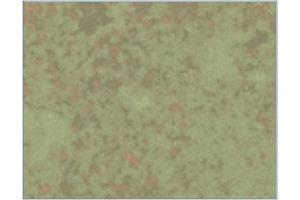 Immunohistochemistry analysis of Listeria infected mice spleens 6 days after infection with L-monocytogenes using AM03145PU (Clone LK2). (HSPD1 Antikörper)