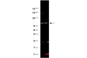 Western blot using  affinity purified anti-FANCG antibody shows detection of a band at ~69 kDa (arrowhead) corresponding to FANCG present in a HeLa whole cell lysate. (FANCG Antikörper  (AA 1-12))