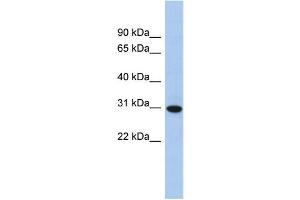 WB Suggested Anti-TMED8 Antibody Titration: 0. (TMED8 Antikörper  (Middle Region))
