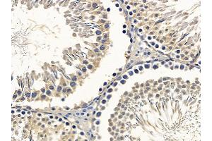 ABIN6257888 and ABIN6275082 at 1/100 staining rat testis tissue by IHC-P. (DNAI2 Antikörper  (N-Term))