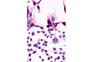 Immunocytochemistry (ICC) staining of HEK293 human embryonic kidney cells transfected (A) or untransfected (B) with GRM3. (Metabotropic Glutamate Receptor 3 Antikörper  (Extracellular Domain))
