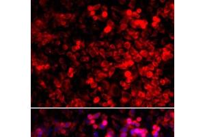 Immunofluorescence analysis of U2OS cells using QARS Polyclonal Antibody (QARS Antikörper)