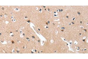Immunohistochemistry of paraffin-embedded Human brain tissue using GRB7 Polyclonal Antibody at dilution 1:40