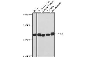 Western blot analysis of extracts of various cell lines, using P Rabbit mAb (ABIN7269156) at 1:1000 dilution. (PAX9 Antikörper)
