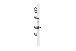 Western Blotting (WB) image for anti-Transforming Growth Factor, beta 1 (TGFB1) (AA 22-50), (N-Term) antibody (ABIN5532245)