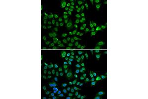 Immunofluorescence analysis of U2OS cells using LMNB2 antibody (ABIN5973877). (Lamin B2 Antikörper)