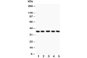Western blot testing of LOX-1 antibody and Lane 1:  rat liver;  2: human HeLa;  3: (h) K562;  4: (h) Raji lysate. (OLR1 Antikörper  (Middle Region))