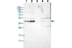 Western blot analysis of Lane 1: RT-4, Lane 2: U-251 MG, Lane 3: Human Plasma, Lane 4: Liver, Lane 5: Tonsil with WDR53 polyclonal antibody  at 1:250-1:500 dilution. (WDR53 Antikörper)