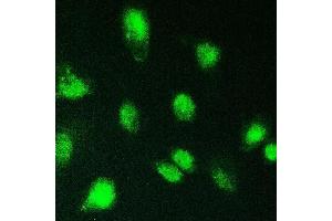 IF analysis of KBTBD2 using anti-KBTBD2 antibody (ABIN6719647). (KBTBD2 Antikörper)