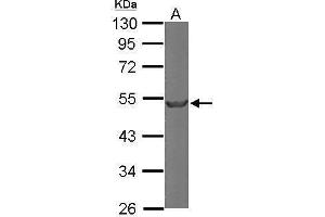 Western Blotting (WB) image for anti-Tubulin, beta 2A (TUBB2A) antibody (ABIN2855204)