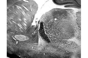 Adult rat reticular thalamic nucleus immunohistochemistry.