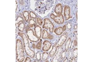 Immunohistochemical staining of human kidney with SLC26A1 polyclonal antibody  shows moderate cytoplasmic positivity in cells in tubules at 1:1000-1:2500 dilution. (SLC26A1 Antikörper)