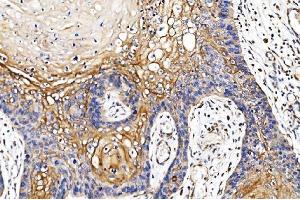 IHC analysis of POR using anti-POR antibody (ABIN7602795).
