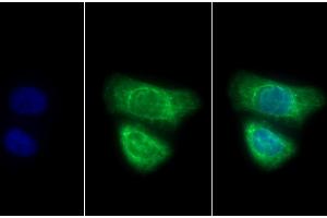 Detection of CK7 in Human HepG2 cell using Polyclonal Antibody to Cytokeratin 7 (CK7) (Cytokeratin 7 Antikörper  (AA 91-394))