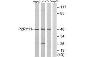 Western blot analysis of extracts from HepG2/Jurkat/COLO cells, using P2RY11 Antibody.