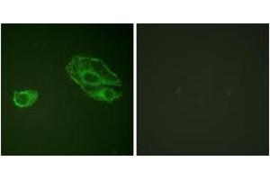 Immunofluorescence analysis of A549 cells, using HER3 (Ab-1289) Antibody. (ERBB3 Antikörper  (AA 1256-1305))