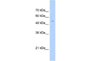 WB Suggested Anti-AGXT2L2 Antibody Titration:  0. (AGXT2L2 Antikörper  (C-Term))