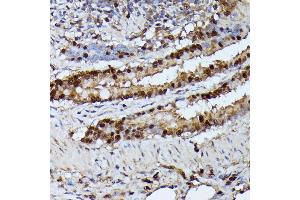 Immunohistochemistry of paraffin-embedded rat lung using GA antibody (ABIN6130412, ABIN6140923, ABIN6140926 and ABIN6215461) at dilution of 1:100 (40x lens).