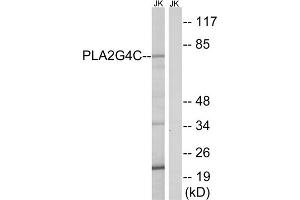 Western blot analysis of extracts from Jurkat cells, using PLA2G4C antibody. (PLA2G4C Antikörper  (Internal Region))