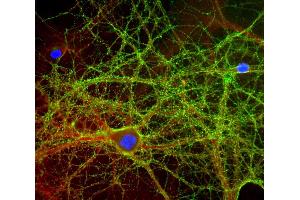 Mixed neuron-glial cultures stained with ABIN1580420 (green) and rabbit antibody to alpha-II spectrin (red), and DNA (blue). (GAP43 Antikörper)