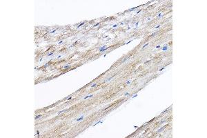 Immunohistochemistry (IHC) image for anti-Ribosomal Protein L8 (RPL8) (AA 1-257) antibody (ABIN6147155)