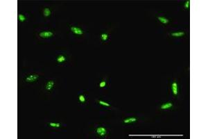 Immunofluorescence (IF) image for anti-Adenosine Deaminase, RNA-Specific (ADAR) (AA 1-1226) antibody (ABIN947535)