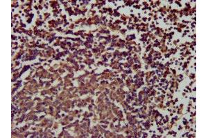 IHC image of ABIN7169782 diluted at 1:200 and staining in paraffin-embedded human lymph node tissue performed on a Leica BondTM system. (SLAMF6 Antikörper  (AA 248-331))