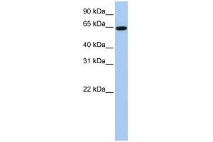WB Suggested Anti-EPS8L1 Antibody Titration:  0. (EPS8-Like 1 Antikörper  (Middle Region))