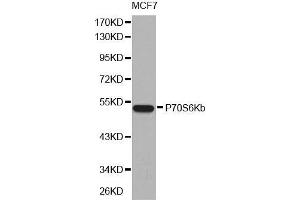 Western blot analysis of extracts of MCF7 cell line, using P70S6Kb antibody. (RPS6KB2 Antikörper  (AA 1-170))