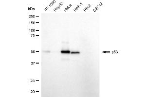 Western blotting analysis using p53 antibody (ABIN7800689).
