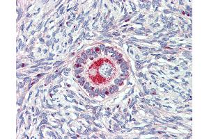 Anti-TM9SF1 antibody IHC of human ovary. (TM9SF1 Antikörper  (Internal Region))