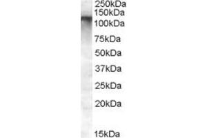 Western Blotting (WB) image for anti-Family with Sequence Similarity 91, Member A1 (FAM91A1) (N-Term) antibody (ABIN2791513) (FAM91A1 Antikörper  (N-Term))