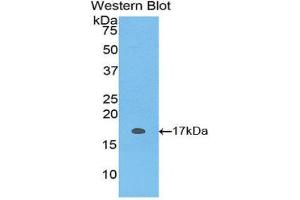 Western Blotting (WB) image for anti-S100 Protein (S100) (AA 1-94) antibody (ABIN1171951) (S100 Protein (S100) (AA 1-94) Antikörper)