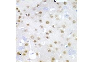 Immunohistochemistry of paraffin-embedded mouse brain using CDC27 antibody (ABIN3015756, ABIN3015757, ABIN1679113 and ABIN6219104) at dilution of 1:200 (40x lens). (CDC27 Antikörper  (AA 551-830))
