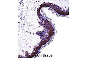 Immunohistochemistry (IHC) image for anti-Proteasome (Prosome, Macropain) Subunit, beta Type, 5 (PSMB5) antibody (ABIN2998050) (PSMB5 Antikörper)