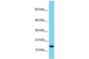 Host: Rabbit Target Name: IDNK Sample Type: OVCAR-3 Whole Cell lysates Antibody Dilution: 1.