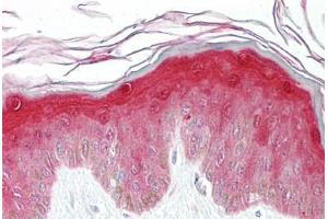 Anti-HSPB1 antibody IHC staining of human skin.