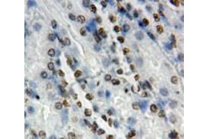 Used in DAB staining on fromalin fixed paraffin-embedded Kidney tissue (NOTCH2 Antikörper  (AA 2251-2466))