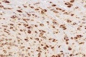Immunohistochemistry (Paraffin-embedded Sections) (IHC (p)) image for anti-Ribosomal Protein L10 (RPL10) antibody (ABIN7075428)