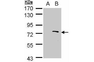 WB Image Western Blot analysis of ZMYND11 expression in transfected 293T cell line by ZMYND11 polyclonal antibody. (ZMYND11 Antikörper)